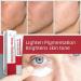 Professional Moisturizing Facial Serum Brightening and Oil Control Whitening Treatment Cream - Buy Online on GoSupps.com