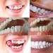 Buy 18K Tooth Gems Starter Kit - Ultrathin Teeth Jewelry with 9 Boxes (3-5mm) | Professional Cross Tooth Gems for Ultimate Shine - Buy Online on GoSupps.com