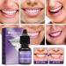 Tooth Jewelry Gemkit - Professional DIY Tooth Gemstone Kit for Stunning Tooth Decoration | Complete Teeth Gems Kit with Lamp & Glue - Buy Online on GoSupps.com