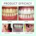 Herbal Fresh Toothpaste - Gentle Formula for Daily Teeth Cleaning Teeth Brightening & Long-Lasting Fresh Breath(3PCS) - Buy Online on GoSupps.com