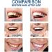 Pure Smile Essence Teeth Whitening Enhancer At-Home Whitening System Professional Teeth Whitening Powerfully Removes All Kinds of Stains - Buy Online on GoSupps.com