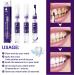 V34 Tooth Creams - Purple Tooth Whitening Gel & Pin | Effective Stain Removal for Bright White Teeth - Buy Online on GoSupps.com
