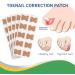Glue Free Toenail Patch - Toenail Correction Stickers with Double-sided Adhesive Paste | Toenail Patch Toenail Repair Tool Soft Toenail Correction for Home Klufo 50pcs - Buy Online on GoSupps.com