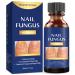 Toenail fungus treatment, Nail Fungus Treatment for Toenail, Toe Nail Fungus Treatment Extra Strength Effective Fingernail and Toenail Fungus Killer,Nail Repair Solution, Restoring Healthy Nails