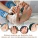 Cutting Silicone Toe Protection - 3 Piece Gel Cushion for Corns & Callus Relief - Toe & Finger Tube Bandage - Available in 3 Sizes - Buy Online on GoSupps.com