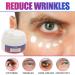 minkissy 2 Eye Cream Dark Circle under Eye Under Eye Bags Cream Men Moisture Eye Wrinkle Cream Dark Circle Corrector Dark Circle Remover Man Skin Care Products Abs - Buy Online on GoSupps.com