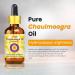 Deve Herbes Huile de Chaulmoogra pure (Hydnocarpus wightiana) avec compte-gouttes en verre press froid 30 ml - Buy Online on GoSupps.com