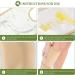 Peosaard Castor Oil Pack for Knee | Reusable Leak-proof & Waterproof Wrap | Thickened Fastening Band | Fast International Shipping - Buy Online on GoSupps.com