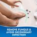 Effective Toenail Fungus Treatment - Restore Healthy Nail Appearance - Buy Online on GoSupps.com