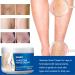 JoanofArc Varicose Veins Repair Cream Reduces Spider Veins & Leg Heaviness Soothing for Legs 50g - Buy Online on GoSupps.com