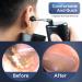 Effective Ear Wax Removal Tool Kit | Water Powered Ear Cleaner with 3 Modes & IPX7 Waterproof Design - Buy Online on GoSupps.com