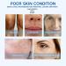 Trendyfave Hyaluronic Acid Serum Serums Skincare Moisturiser Face Women For Anti Aging Firming And Plumping Of Skin Fine Lines Deep Wrinkle Filler Brightening Serum Hydrating Serum With Glycerin - Buy Online on GoSupps.com