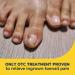 Buy Dr. Scholl's Ingrown Toenail Pain Reliever & Trimming Kit - OTC Treatment for Effective Pain Relief - Medicated Gel Foam Rings Bandages Clipper & Pusher Tools Included - Buy Online on GoSupps.com