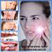 Mouth Guard for Teeth Grinding and Clenching 4 Pack Mouth Shield for Teeth Grinding at Night to Stops Bruxism Reusable Mouth Guards Grinding Teeth for Adults & Kids - Buy Online on GoSupps.com