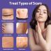 Silicone Scar Sheets 1.6 x 120 Roll - Reusable Tape for Scar Removal - Ideal for C-Section, Surgical Scars, Stretch Marks, Acne, Tummy Tuck - Buy Online on GoSupps.com