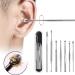 2sets Unisex Stainless Steel Spring Spiral Ear Pick Spoon Wax Removal Cleaner Ear Clean Tool - Buy Online on GoSupps.com
