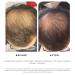 Dr. Groot Scalp Revitalizing Solution Travel Set | Hair Thickening Shampoo & Treatment | TSA Approved Korean Hair Care with Rosemary Oil - Buy Online on GoSupps.com