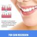 WRANBAO Gum repair gel for gum recession gum protection and repair gel gum protection and oral care dental care gel deep cleaning freshens breath 4 pieces - Buy Online on GoSupps.com