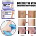 Cream against spider veins for effective treatment of varicose veins Treatment Legs Cream soothes and moisturizes quickly - Buy Online on GoSupps.com