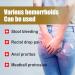 Buy Chinese Herbal Hemorrhoid Cream | Natural Relief for Men & Women - Fast International Shipping - Buy Online on GoSupps.com