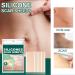 Professional Silicone Scar Removal Sheets - Reusable Gel Strips for Keloid, C-Section, Surgery, Burn, Acne - Stretch Marks Patch Away Tape - Buy Online on GoSupps.com