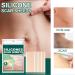 Silicone Scar Cover Up Tape for Stretch Marks - Professional Gel Sheets for Body Skin Care - Buy Online on GoSupps.com