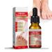 Ingrown Toenail Treatment Ingrowing Toenail Treatment Nail Growth Treatment Natural Ingrown Toenail Correction Nail Treatments Trimming Toenail Softening Drops Toe Nail Fungal Treatment(10ml)