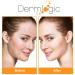 Acne Treatment Control Pads with Salicylic, Glycolic & Lactic Acid - Clears Pores, Oily Skin & Breakouts. Removes Dark Spots & Pimples - Buy Online on GoSupps.com