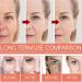 KOAHDE Squalane Deep Moisture Serum Squalane Dark Spot Corrector Serum Squalane Acne Reduce Serum Squalane Hydrating Serum Squalane Brighten Skin Serum Squalane Shrink Pores Facial Serum Collagen - Buy Online on GoSupps.com