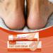 Dry Foot Cream Moisturizing and Softening Cream Corn Remover for Dry Heels | for Cracked Feet Dead Skin Knees Elbows Body Night Day Travel Winter Men and Women - Buy Online on GoSupps.com