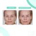 Buy Serious Skincare Glycolic Cleanser 4 oz - Exfoliating Face Wash for Radiant Skin | International Shipping - Buy Online on GoSupps.com
