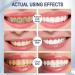 Foam Toothpaste Whitening & Deep Cleaning with Baking Soda | Ultra-fine Mousse for Optimal Oral Care - Buy Online on GoSupps.com