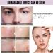 10% Niacinamide Serum+ 1% Zinc Serum Niacinamide Face Serum Face Moisturiser Serum Face Skincare Anti Aging Serum for Face High-Strength Vitamin Face Oils and Serums Brightening Serum Minimises Pore - Buy Online on GoSupps.com