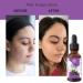 Relaxcation Elderberry Seed Oil Cold Pressed Unrefined Carrier Oil for Face Hair Nails & Body | Lightweight Botanical Extract for Travel Glow Blends & Skin Care (4 oz) 4 Fl Oz (Pack of 1) - Buy Online on GoSupps.com