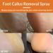 Foot Callus Removal Spray - Exfoliating Hydrating & Softening for Cracked Heels | International Shipping Available - Buy Online on GoSupps.com