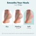 PURDERM Exfoliating Heel Mask - 1 Pair | Foot Peel Masks for Dead Skin & Cracked Heels | Intensive Care for Dry Skin & Calluses | Vegan Formula with Key Ingredients - Buy Online on GoSupps.com