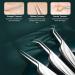 FVION Blackhead and Acne Extractor Kit - Professional 6 PCS Pimple Popper Tool Set for Face - Acne Tweezers and Blackhead Remover Tools - Buy Online on GoSupps.com