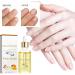 Cuticle Oil for Nails Nail Oil Cuticle with Vitamin E Soothe Moisturize Nail Cuticle Oil Moisturizes Cuticle and Nail's Skin Strengthens Nails Prevents Hangnails and Chapped 15ML - Buy Online on GoSupps.com