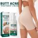  Uzionoie Butt Acne Cream Cream to Remove Acne on Buttocks Reduces Butt Pimples Restores Soft and Smooth Butt Skin 100ml - Buy Online on GoSupps.com
