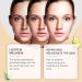 Melanin Correcting Cream Spot Cream For Melanin Correcting Melanin Correcting Body Cream Freckle Removal Cream Dark Spot Remover For Face Dark Spot Corrector Stick For Body Knees Neck Armpit - Buy Online on GoSupps.com