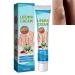 Lipoma Care Cream Lipoma Removal Cream Lipoma Elimination Cream Lipoma Creams Lump Free Cream Herbal Lipoma Removal Balm Cream Get Rid of Your Fatty Lipoma Lumps Herbal Internally Lipoma Removal Balm