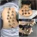 GSJNHY MOXA Rolls 180 Mini-Moxa Tubes - Smokeless Moxibustion Stickers for Effective Therapy & Body Relief (180pcs) - Buy Online on GoSupps.com
