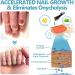4PCS Nail Strengthener for Weak Nails Nail Conditioner for Damaged Nails Onyxoguard Nail Growth and Repair Essence Nail Hardener Extra Strong and Growth Nail Guards for Strength - Buy Online on GoSupps.com