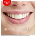 Colgate Max White Ultimate LED Teeth Whitening Kit | Enamel Safe | Up to 20 Years of Stain Reversal | Whitening Pen & Smartphone Powered - Buy Online on GoSupps.com