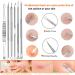 Ybaoo 18PCS Blackhead Remover Tools Kit - Professional Stainless Acne Extractor Set with Metal Case for Blemish Comedone Removal - 2022 Latest - Buy Online on GoSupps.com