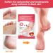 Colexy Foot Mask - 2 Pairs Exfoliating Peeling Socks for Delicate Feet | Remove Dead Skin & Cornea | Strawberry Scented Foot Spa Treatment - Buy Online on GoSupps.com