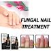 CAOQAO Nail Fix Solution Thickened Bright Nails To Get Rid Of Nail Dead Skin Fix Moisturizing Nail Nutrition Care Solution 30ml Nail Suction (B One Size) 1 count (Pack of 1) B - Buy Online on GoSupps.com
