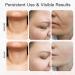 Neck Face Massager 3 Color Modes & Vibration Facial Sculpting Tool for Double Chin & Skin Care (White) International Shipping Available - Buy Online on GoSupps.com