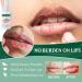 Mouth Ulcer Treatment Spray 30ml Mouth Ulcer Spray OralCare Propolis Ulcer Relief Spray for Wound Protection & Relief Canker Sore Treatment Herbal Mouth Spray Breath Spray for Bad Breath (2Pcs) - Buy Online on GoSupps.com