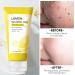 Buy Lemon Sparkling Peeling Gel - Brightening & Deep Exfoliator for All Skin Types | 3.38 Oz - International Shipping Available - Buy Online on GoSupps.com